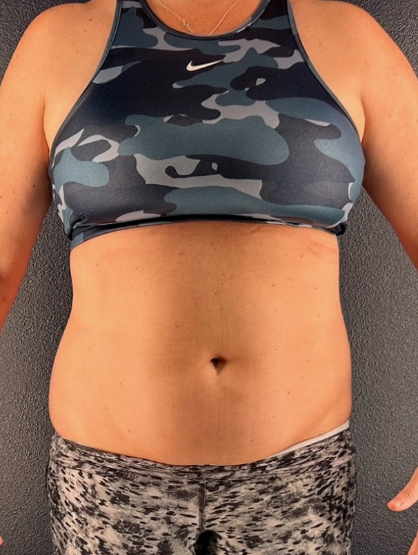 One-Year Inflammation Reset - before