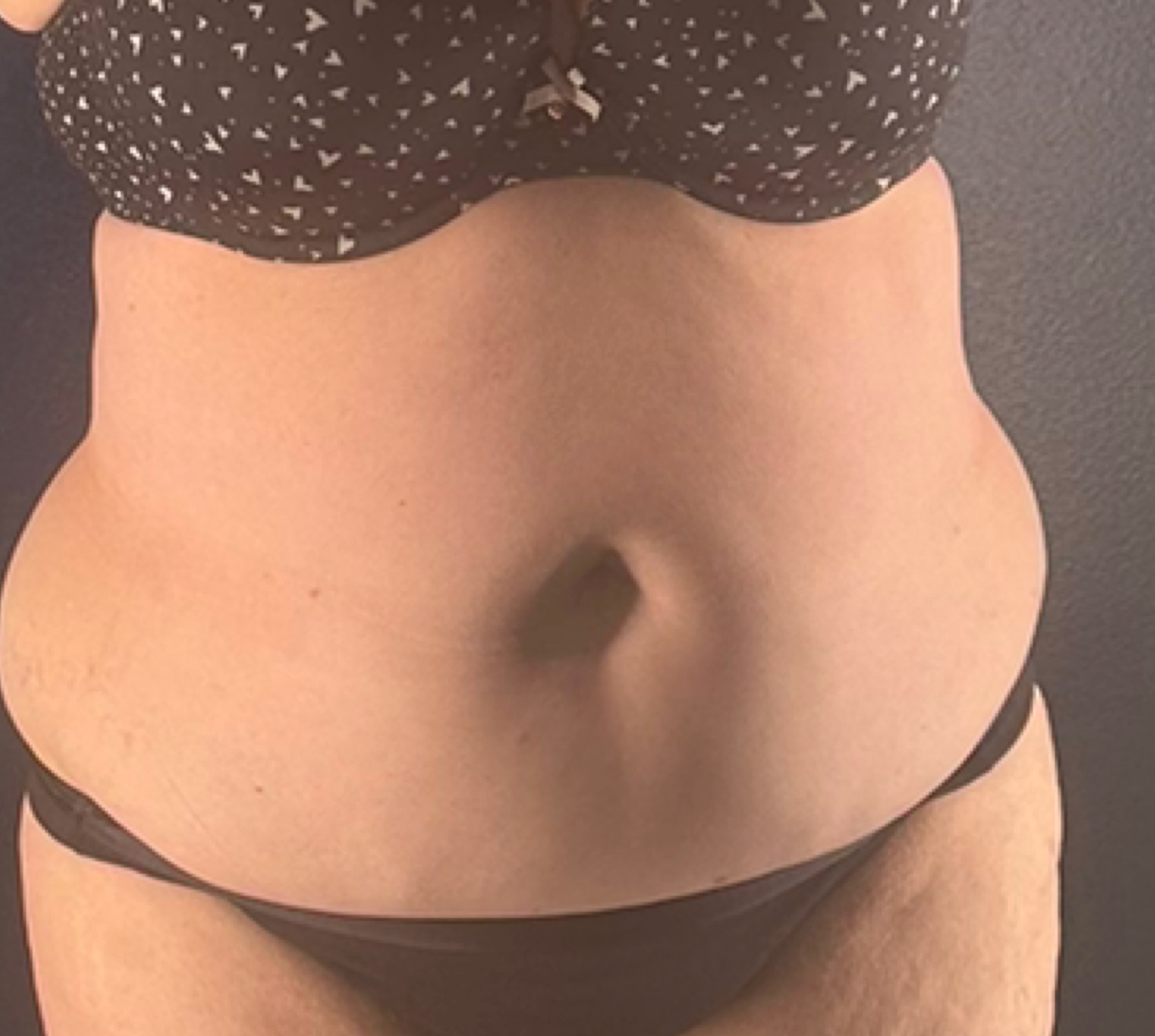 30-Day Lymphatic Reset + Core Sculpt - before