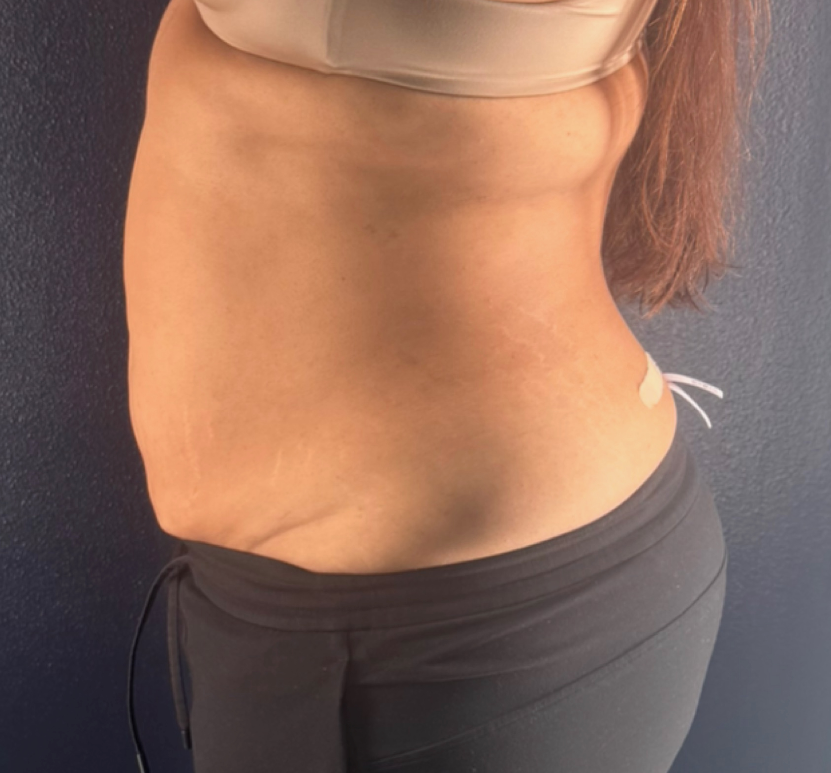 30-Day Lymphatic Reset + Anti-Inflammation Diet - after