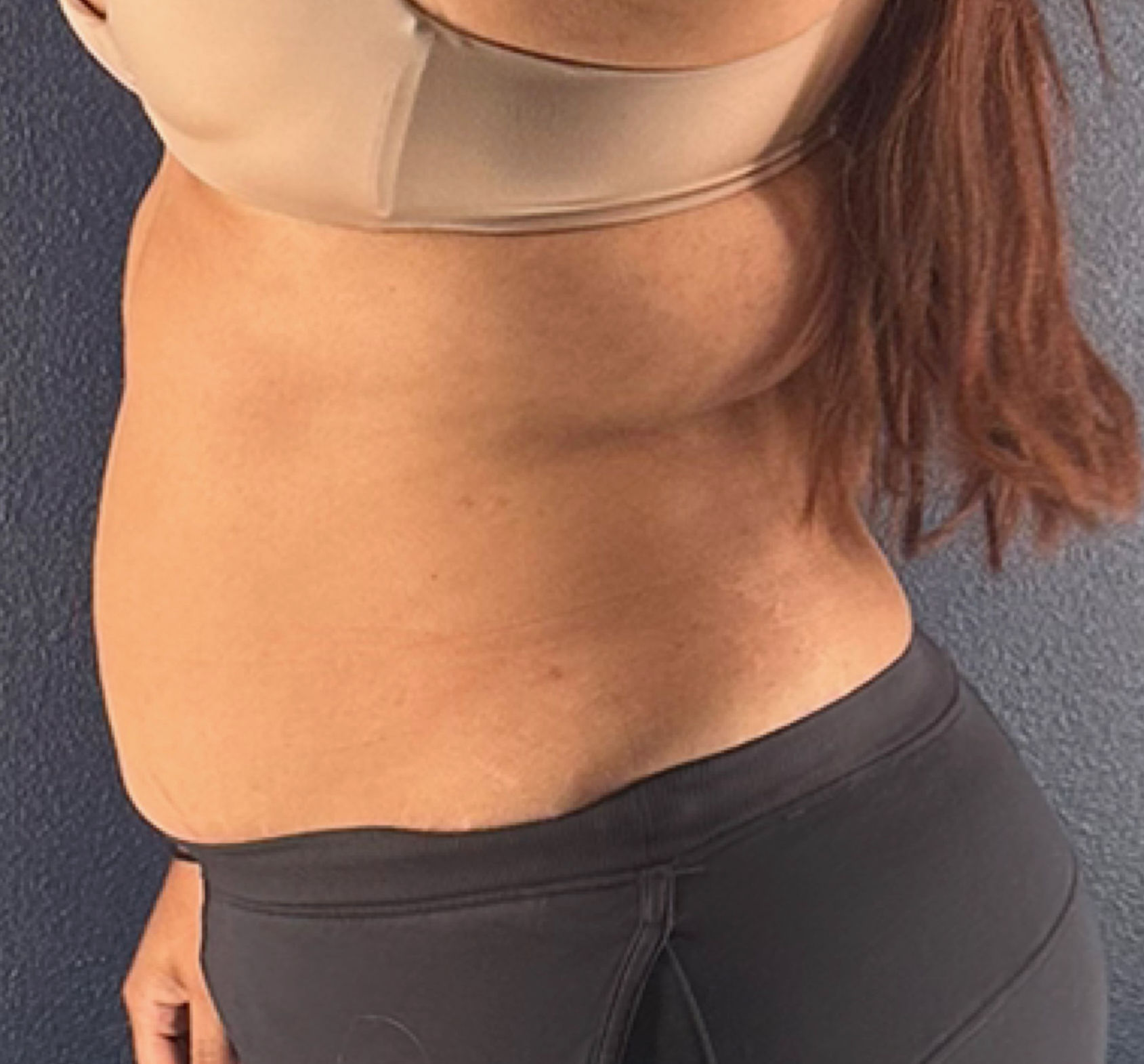 30-Day Lymphatic Reset + Anti-Inflammation Diet - before