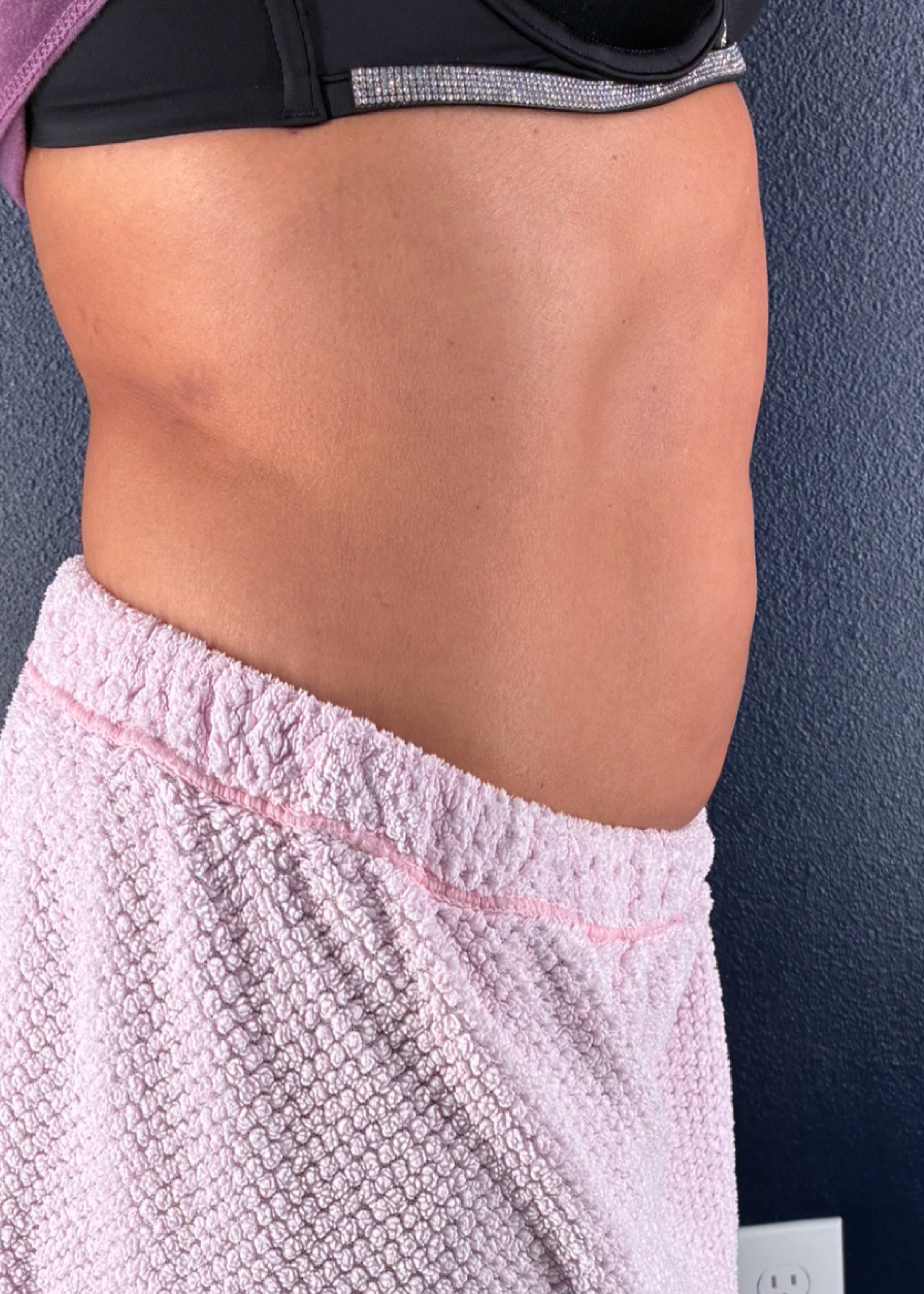 Snatched. Without the Starvation. - before